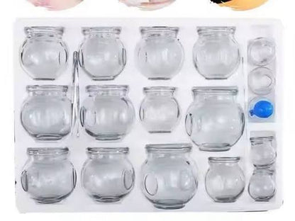 طقم كاسات حجامة ١٠ كاسات بأحجام مختلفة بدون مسدس شفط | Cupping Cups Set 10 Pieces